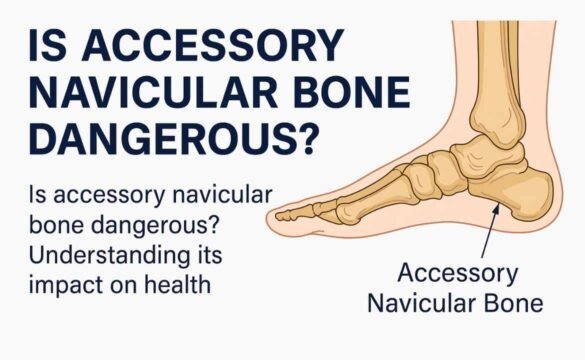 Is Accessory Navicular Bone Dangerous